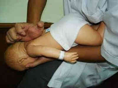 Cách sơ cứu khi trẻ bị hóc