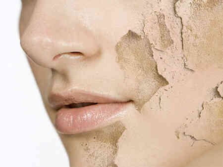 Cách chăm sóc da khô ngày hè